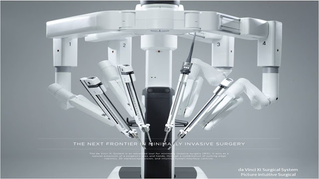 Robot assisted surgery for Gastrointestinal Robot assisted surgery for Gastrointestinal